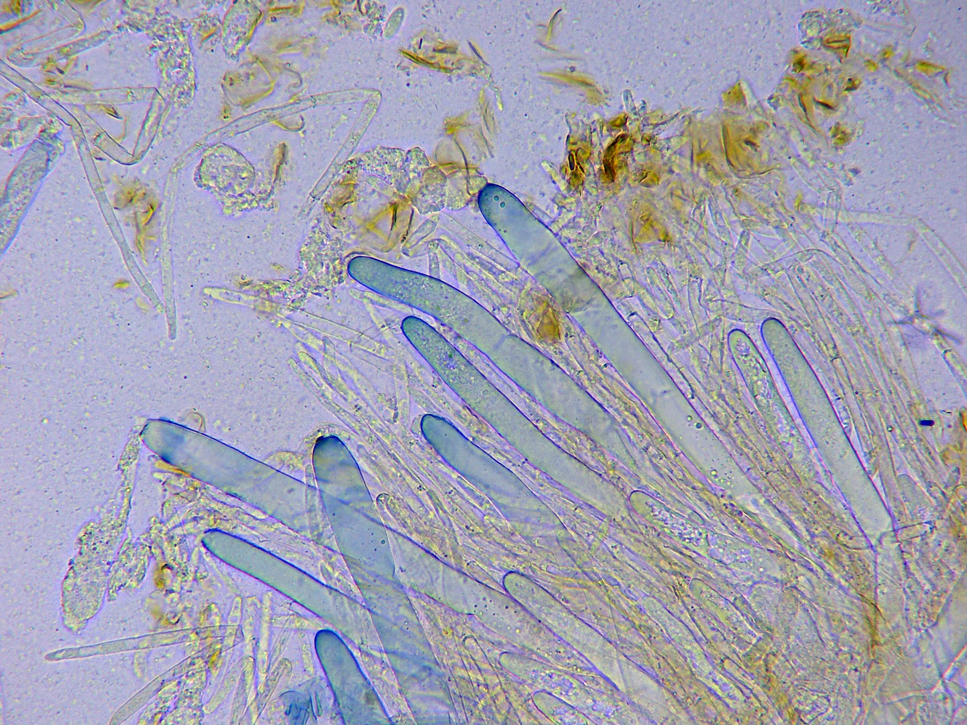 Microscopía de Phylloscypha phyllogena - 10 - Ascos Melzer x 400-002
